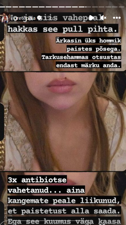 Grete Paia vajas reisil arstiabi