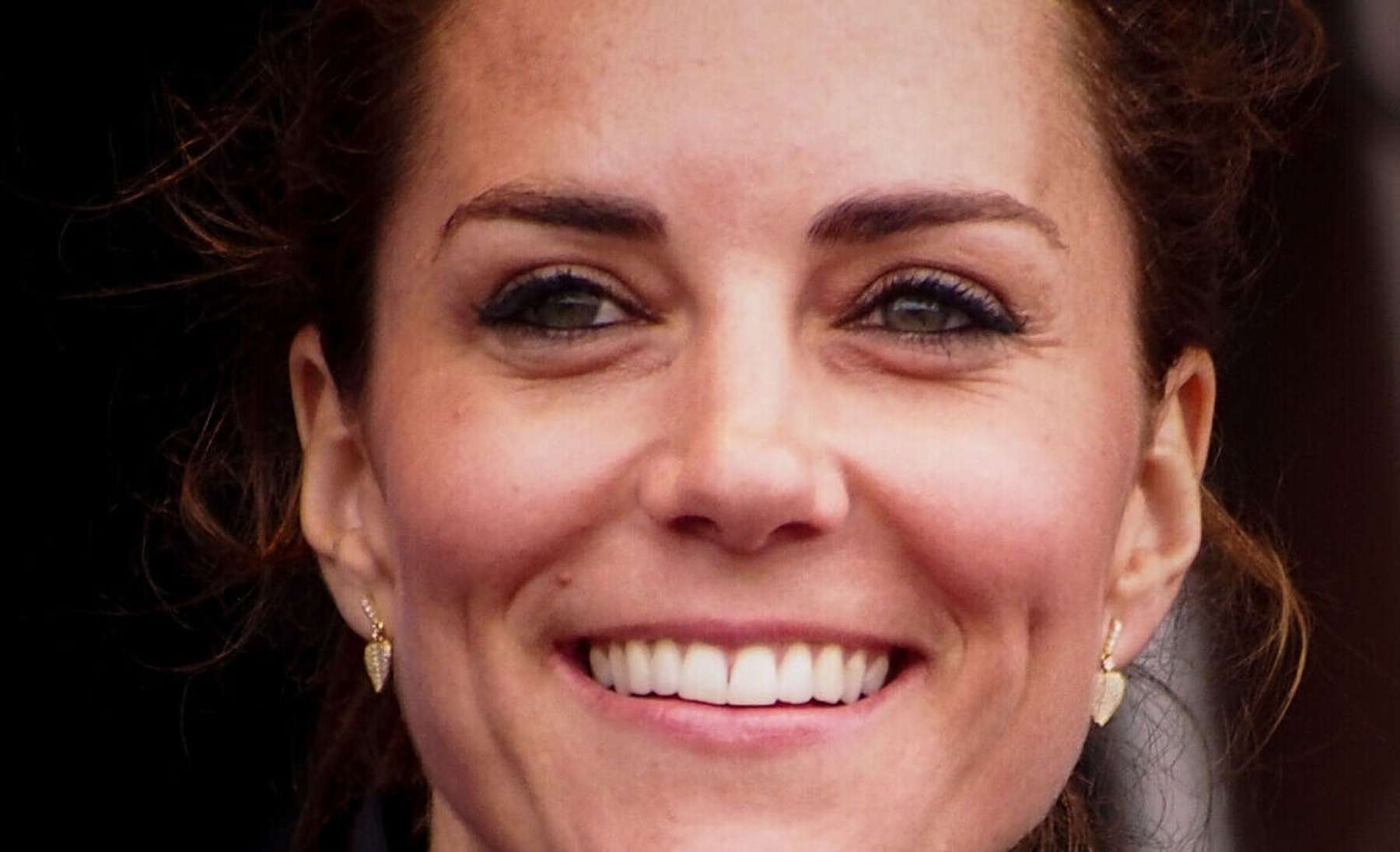 Palee: Walesi printsess Kate jääb operatsiooni järel haiglasse
