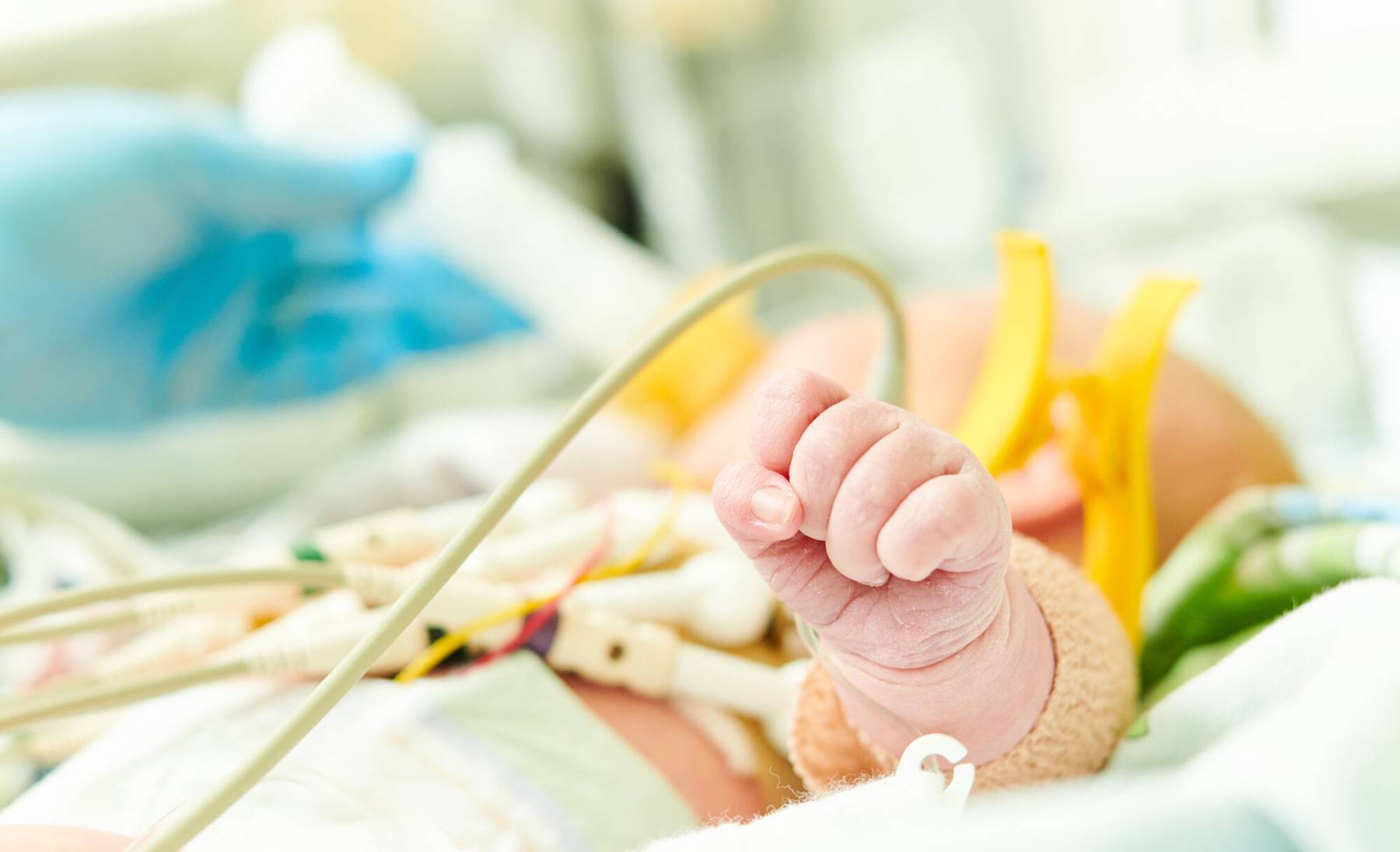 Tallinna Pelgulinna sünnitusmaja enneaegsed beebid saavad annetajate toel elupäästva raviaparatuuri.